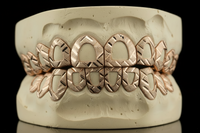 Open Face Gold Grillz -  DQ1018
