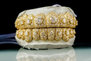 Moissanite Honeymoon Set Grillz DQ1057