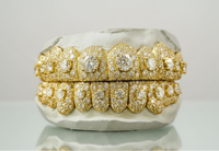 VVS Moissanite Honeymoon Set Grillz - DQ1057