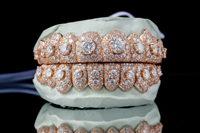 Moissanite Honeymoon Set Grillz DQ1057