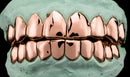 Dental Gold Grillz - NPG or 8K Gold Grillz