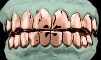 Dental Gold Grillz - NPG or 8K Gold Grillz