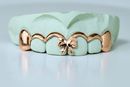 Ribbon Grillz Top 6 DQ1967