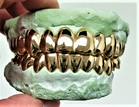 Dental Gold Grillz - NPG or 8K Gold Grillz