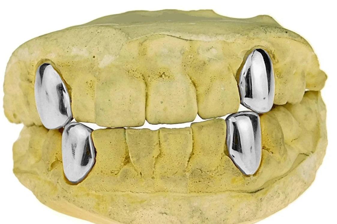 Custom Single Sterling Silver Grillz – Premium Quality & Shine