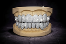 VVS Natural Diamond Honeycomb Set Grillz: Luxury for Your Smile DQ1043