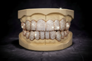 VVS Natural Diamond Honeycomb Set Grillz: Luxury for Your Smile DQ1043