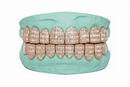 Emerald Cut Moissanite Grillz - DQ8626