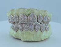 Moissanite VVS Quality Iced Out  Grillz - DQ1002