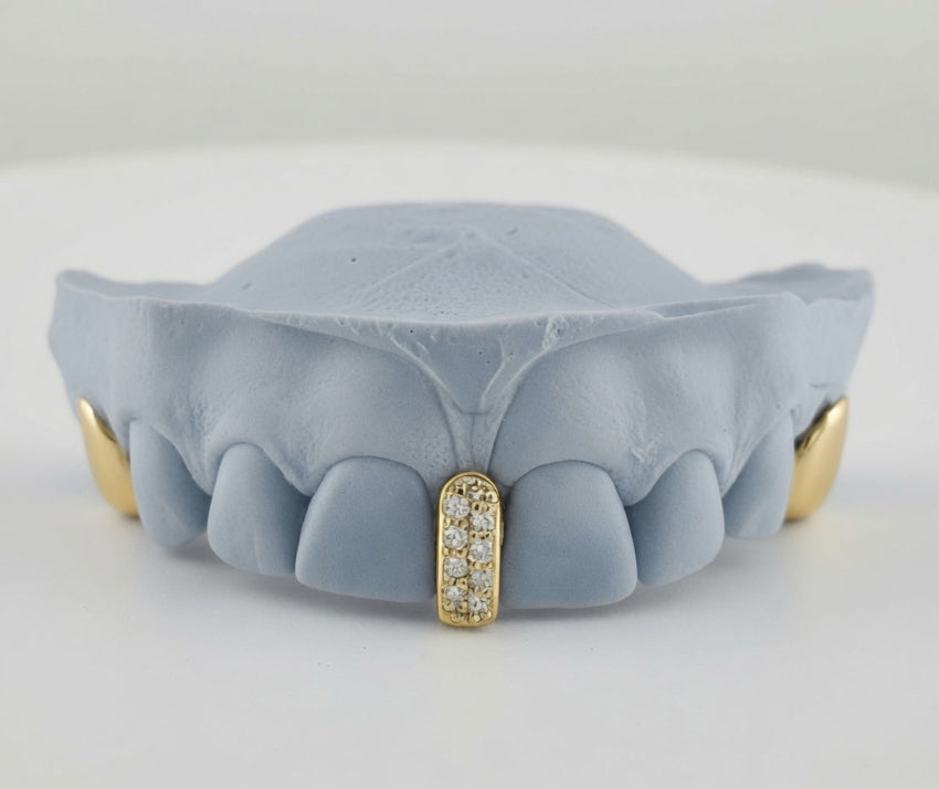 Diamond Strip | Gap Filler Set | 2 Solid Gold DQ1045