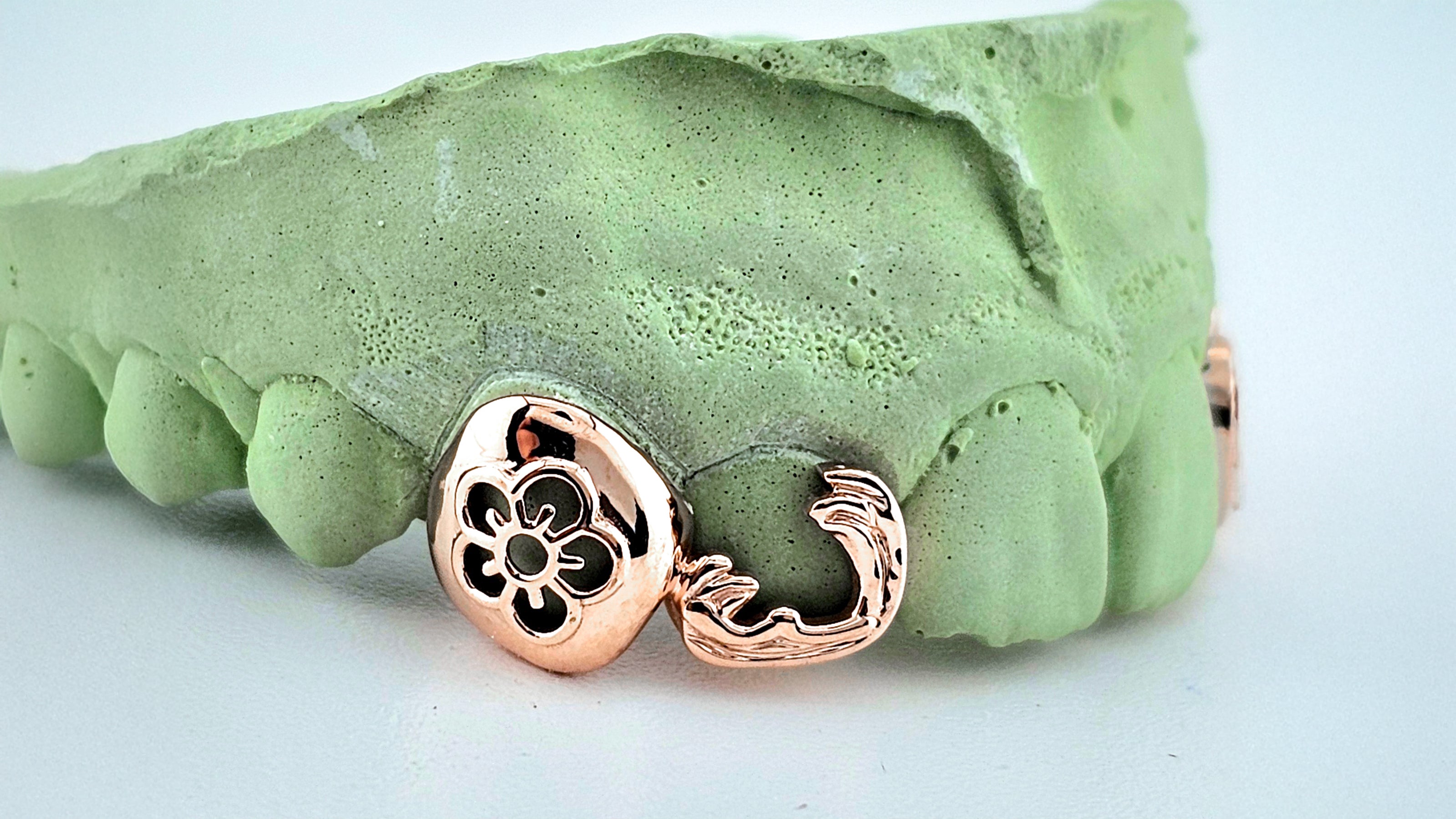 Cherry Bloom Grillz – 2 Tooth Rose Gold Set