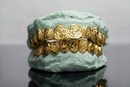 Rose Cut Gold Grillz - DQ1026