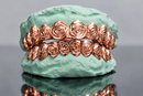 Rose Cut Gold Grillz - DQ1026
