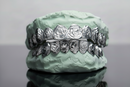 Rose Cut Gold Grillz - DQ1026