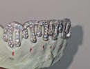 Silver Moissanite Drip Grillz 6pc DQ1053