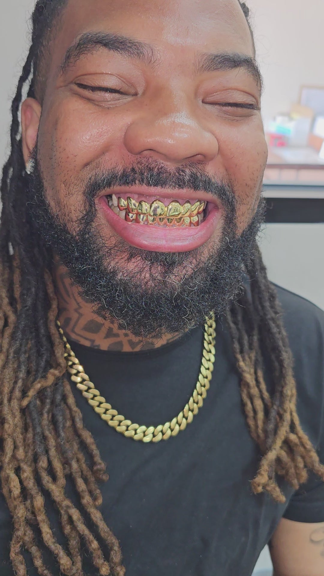 Dental Gold Grillz - NPG or 8K Gold Grillz