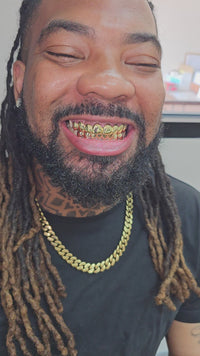 Dental Gold Grillz - NPG or 8K Gold Grillz